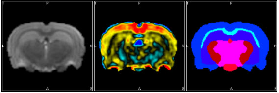 fMRI Brain Atlas Segmentation Tool