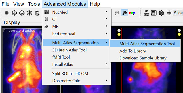 Multi-Atlas Segmentation
