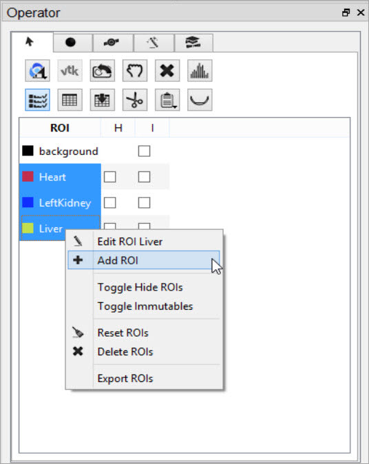 Right-click Add ROI