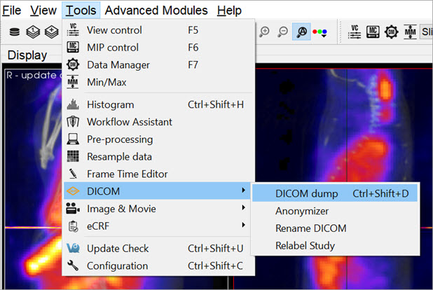 DICOM Dump