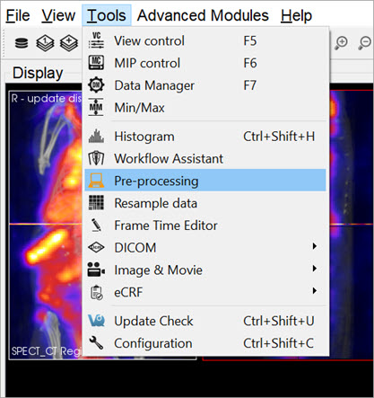 Preprocessing Tool