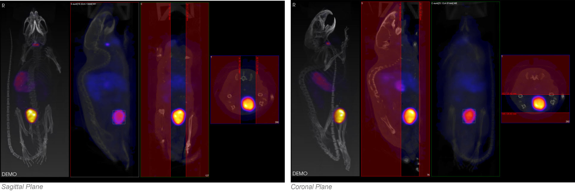 Sagittal and Coronal Planes