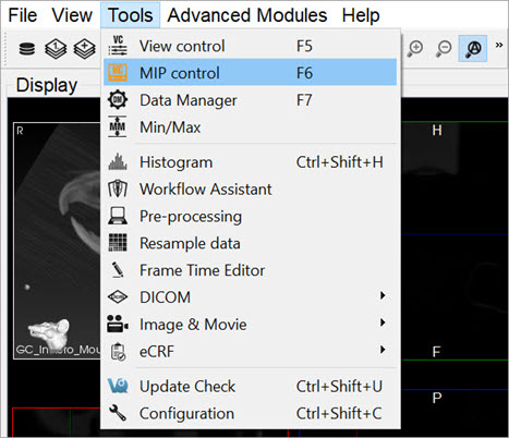 MIP Controls