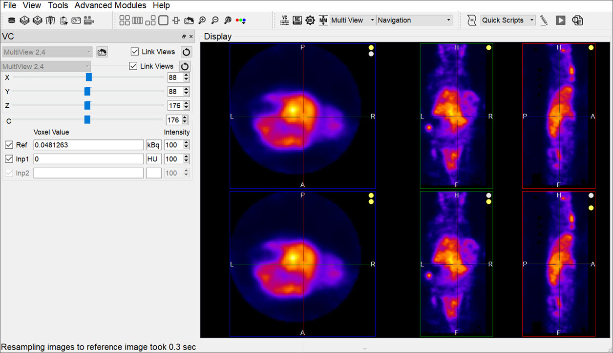 2022] Como usar o Multi View