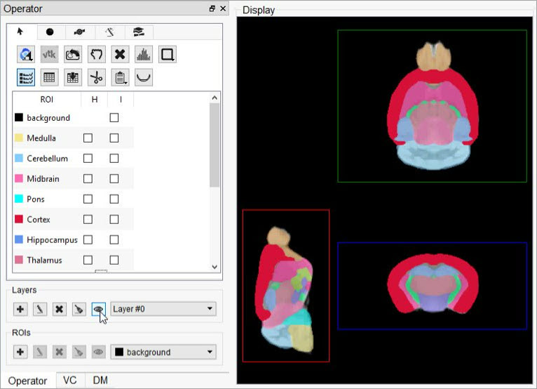 Brain sections separately defined as ROIs in Layer 0