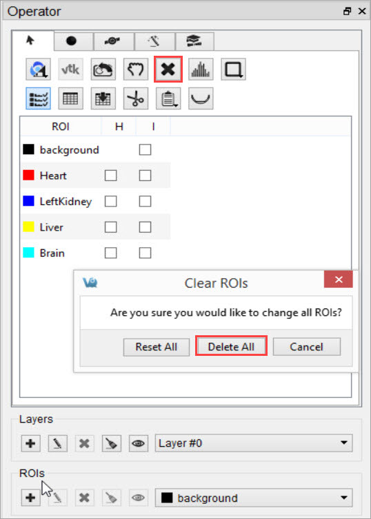 Delete All ROIs