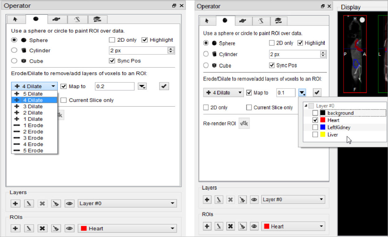 Perform Erosion/Dilation