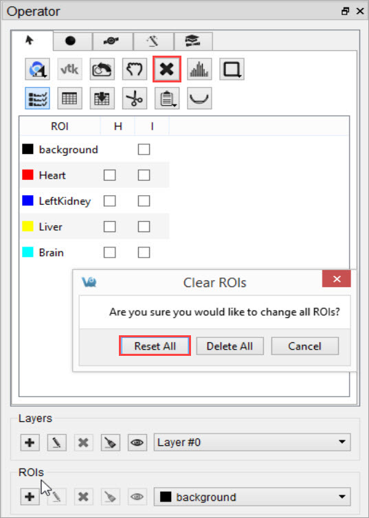 Reset All ROIs