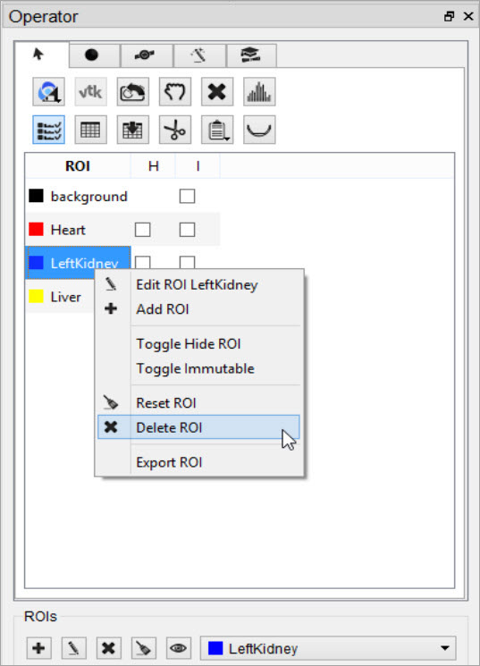 Right-click Delete ROI