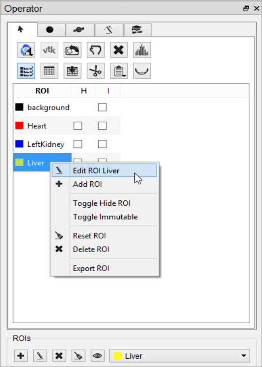 Right-click Edit ROI