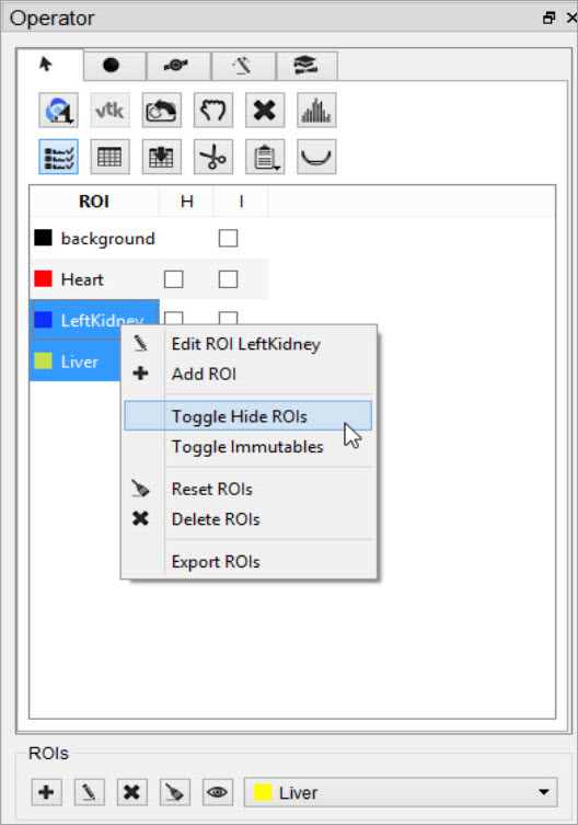 Right-click Hide ROI