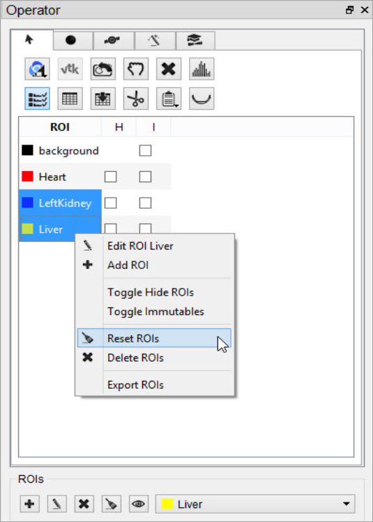 Right-click Reset ROI