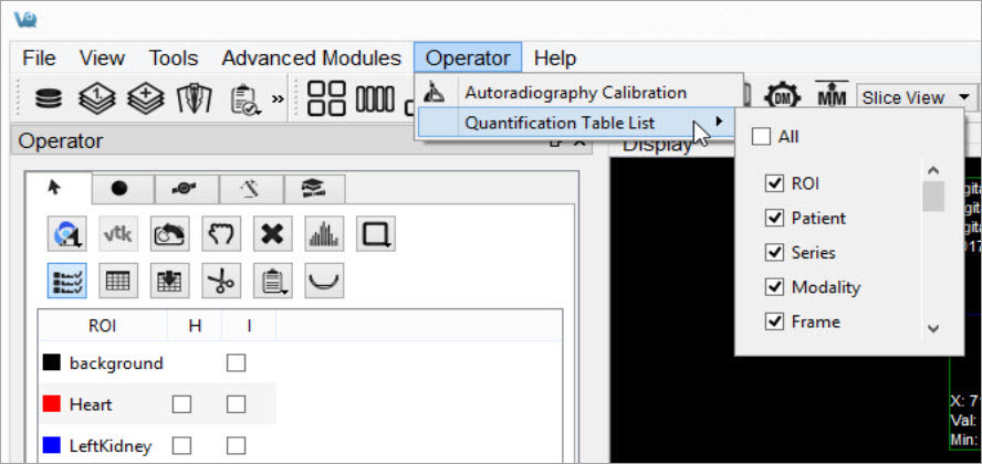 Set Quantification Table Columns