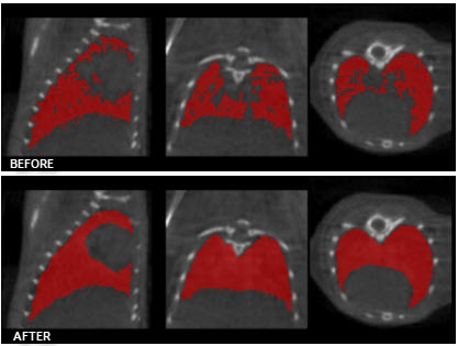 Before/After ROI Max Size