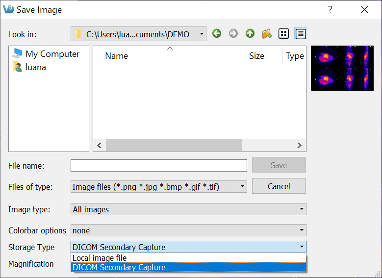 DICOM Secondary Capture Option