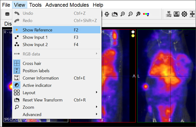 Show Reference / Input