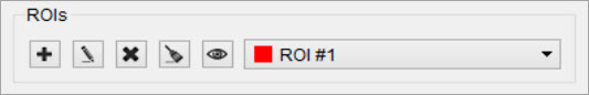 ROI Creation and Deletion