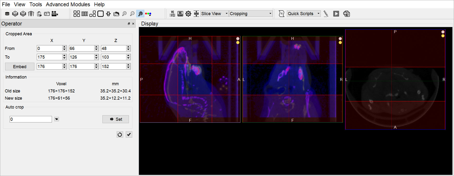 Cropping Sliders