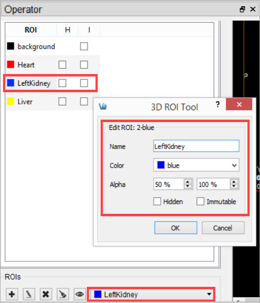 Edit ROI