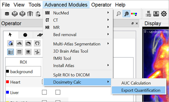 Export Quantification