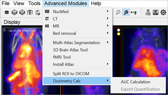 Dosimetry Calculation Tools