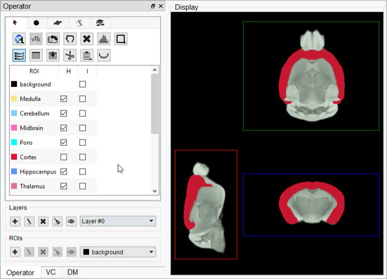 Cortex brain section (red) defined in Layer 0 over whole brain (green) of Layer 1