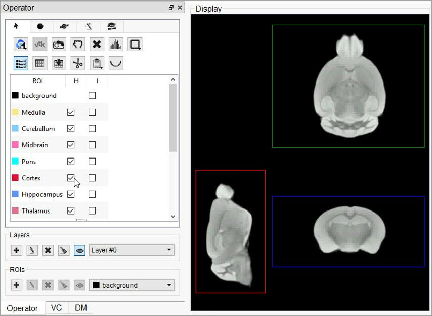 No brain sections defined