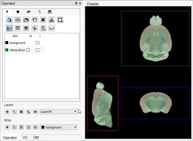 Whole brain section (green) layered over cortex brain section (red)