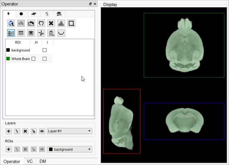 Whole brain ROI (in green) defined in Layer 1