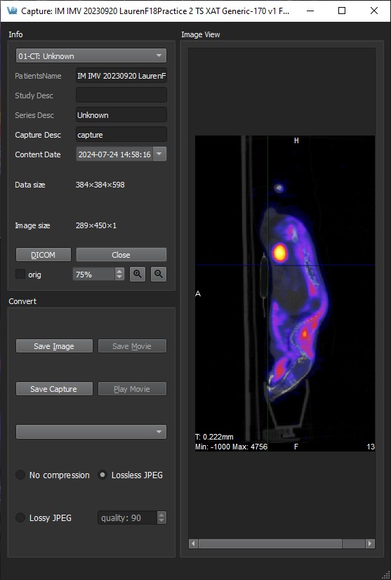 Capture Viewer Panel