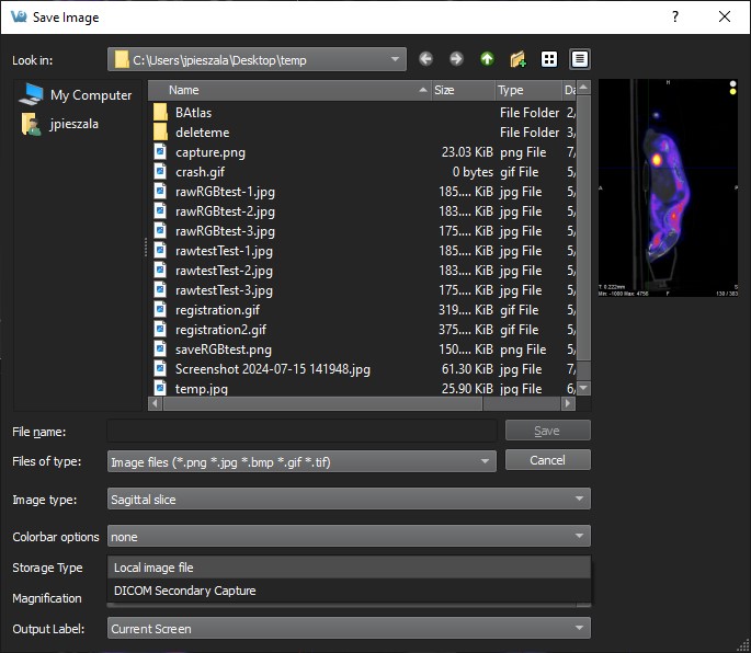 DICOM Secondary Capture Option