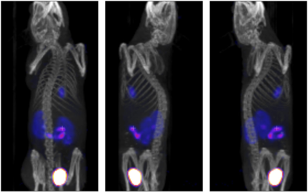 MIP Projections Example Image
