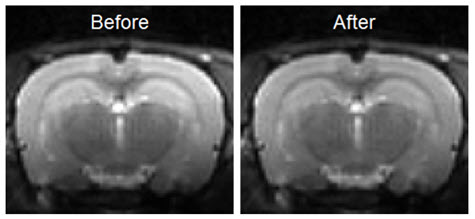 Bias Field Correction