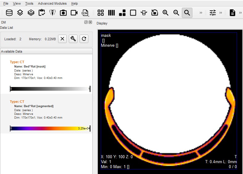 Basic Bed Removal Files
