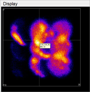 Projections vs. Reconstructions
