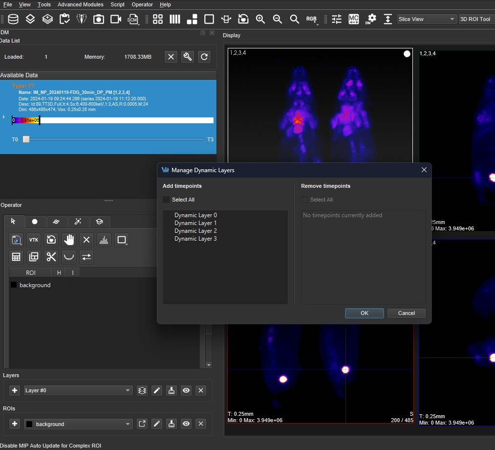 3D ROI Dynamic Layers