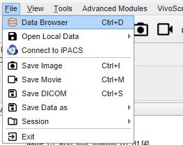 Data Browser