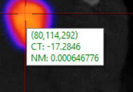 Tooltip
