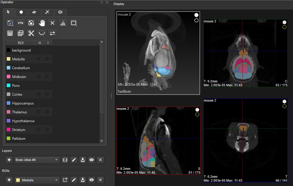Brain sections separately defined as ROIs in Layer 0
