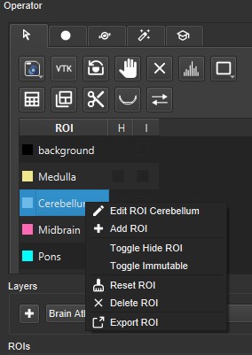 Right-click Add ROI
