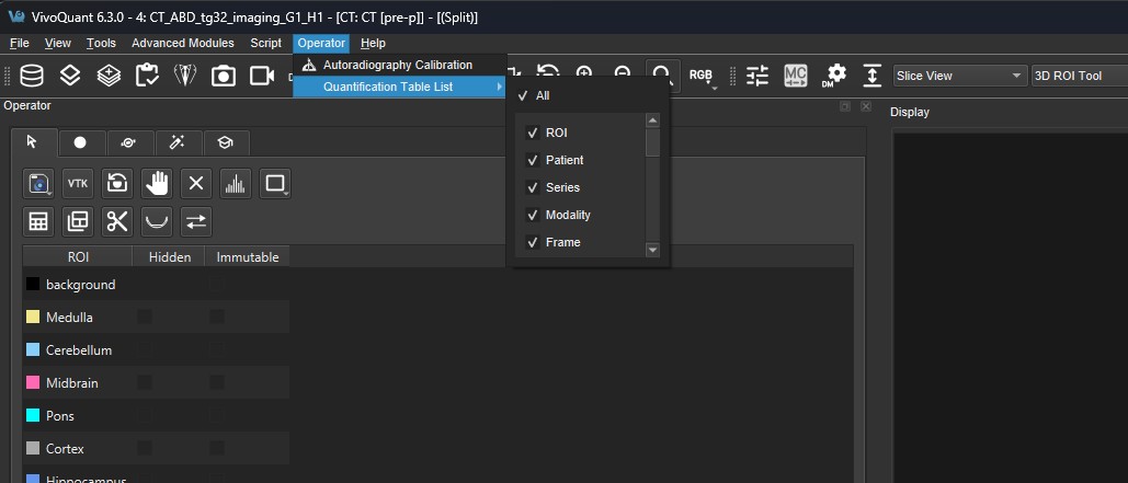 Set Quantification Table Columns