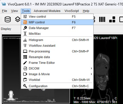 MIP Controls
