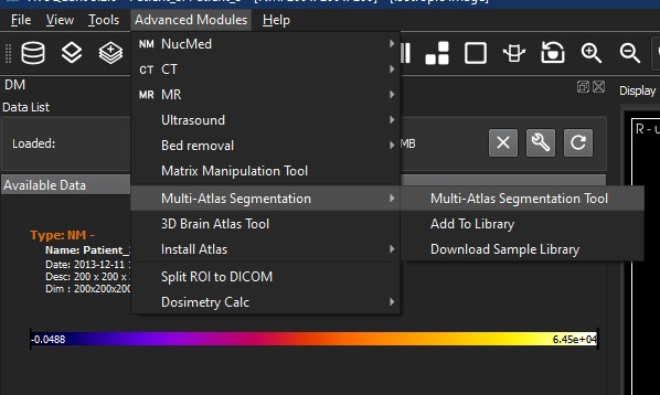 Multi-Atlas Segmentation