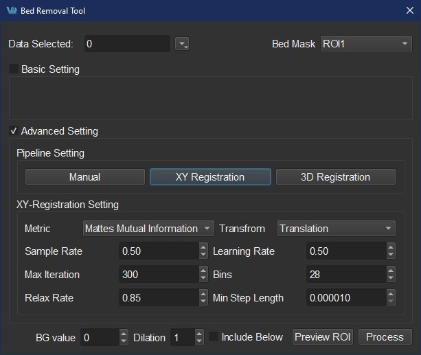 Advanced Bed Removal settings