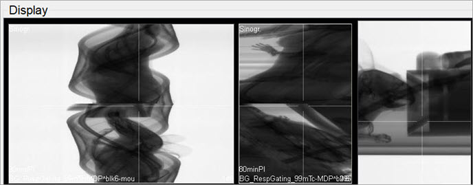Sinogram