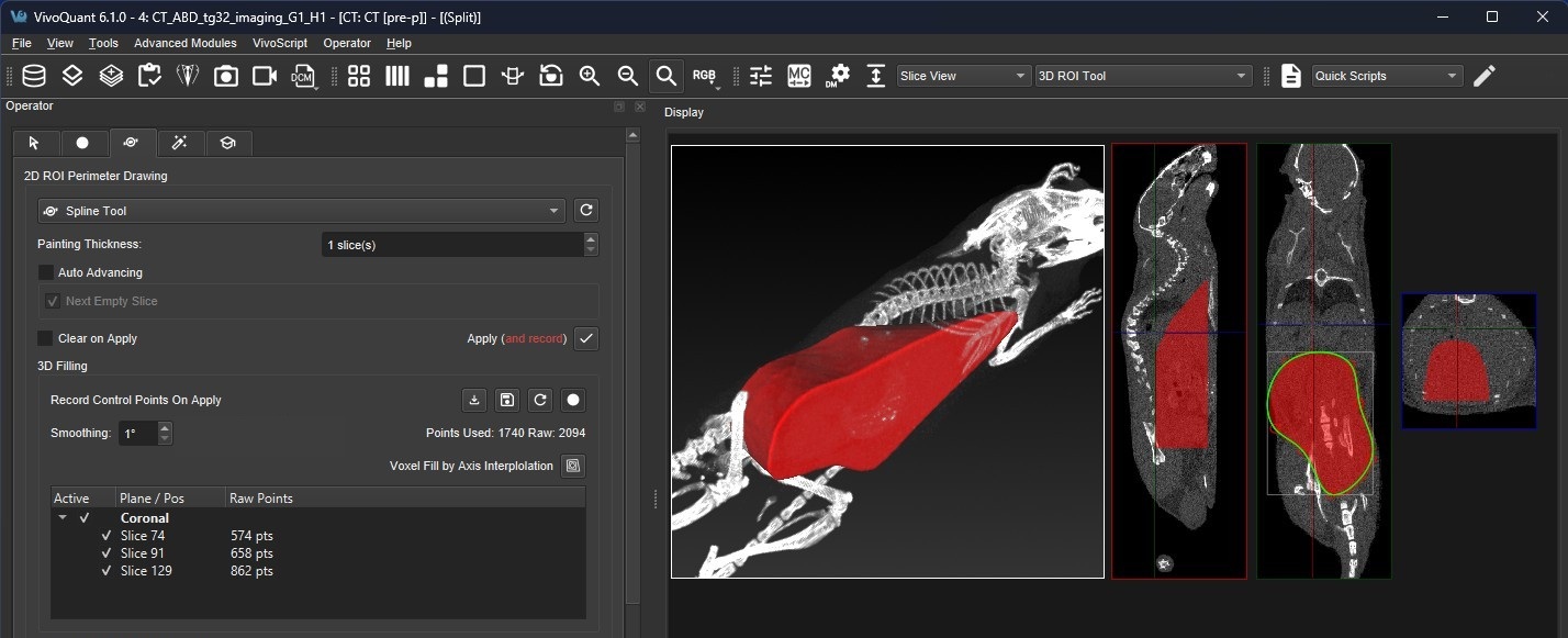 3D Segmentation After