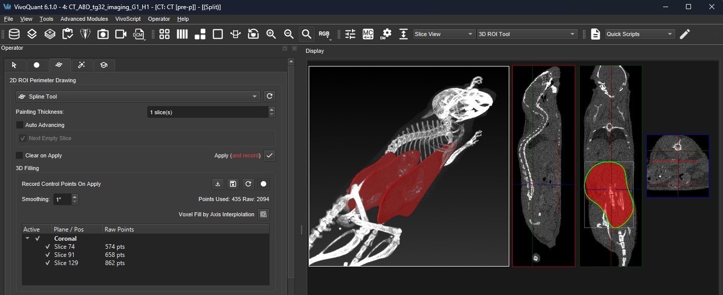 3D Segmentation Before